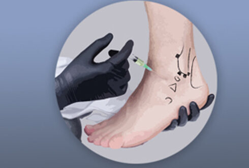 Atelier pratique de prolothérapie pour le médecin de première ligne