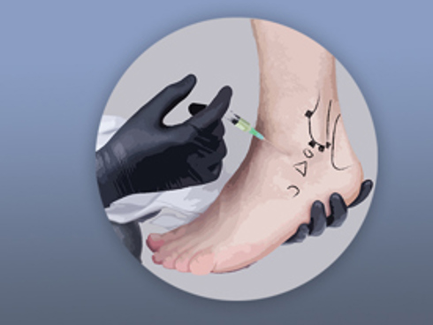 Atelier pratique de prolothérapie pour le médecin de première ligne